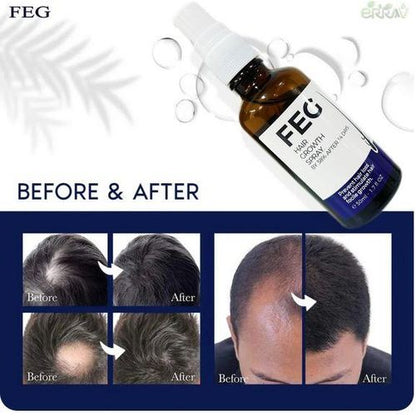ReGrow+ Herbal Hair Growth Spray  Boost Volume & Reduce Hair Fall Naturally