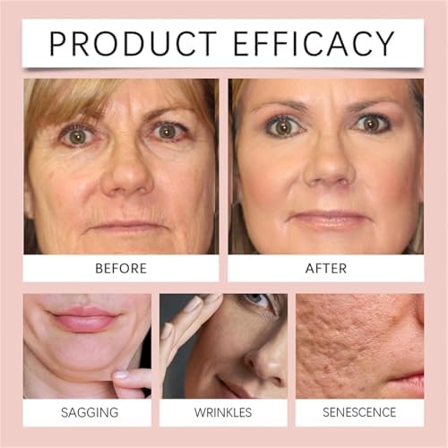 Medicube Collagen Night Peel-Off Mask  Wake Up to Youthful, Glowing Skin