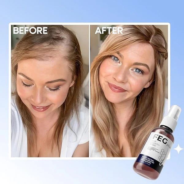 ReGrow+ Herbal Hair Growth Spray  Boost Volume & Reduce Hair Fall Naturally