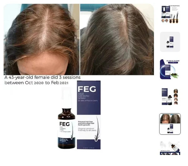 ReGrow+ Herbal Hair Growth Spray  Boost Volume & Reduce Hair Fall Naturally