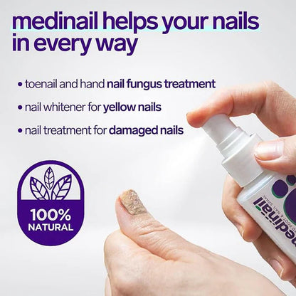 Anti-Fungal Nail Spray for Healthy, Clear Nails