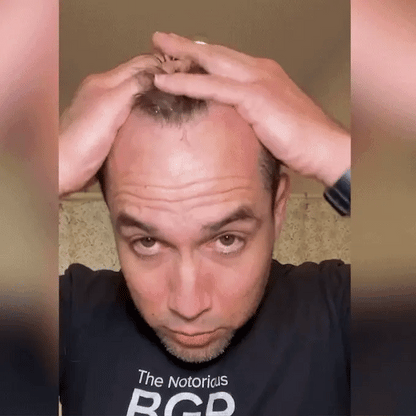 ReGrow+ Herbal Hair Growth Spray  Boost Volume & Reduce Hair Fall Naturally